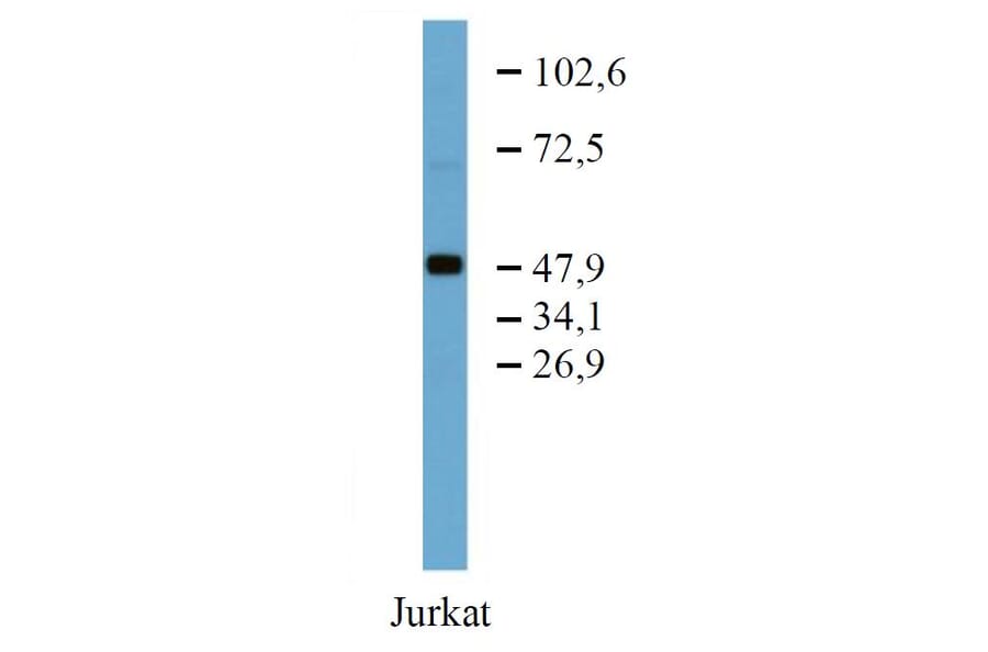WB - Anti-TRK Fused Gene Antibody [TFG-03] (A86721)