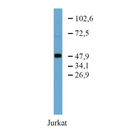 WB - Anti-TRK Fused Gene Antibody [TFG-03] (A86721)