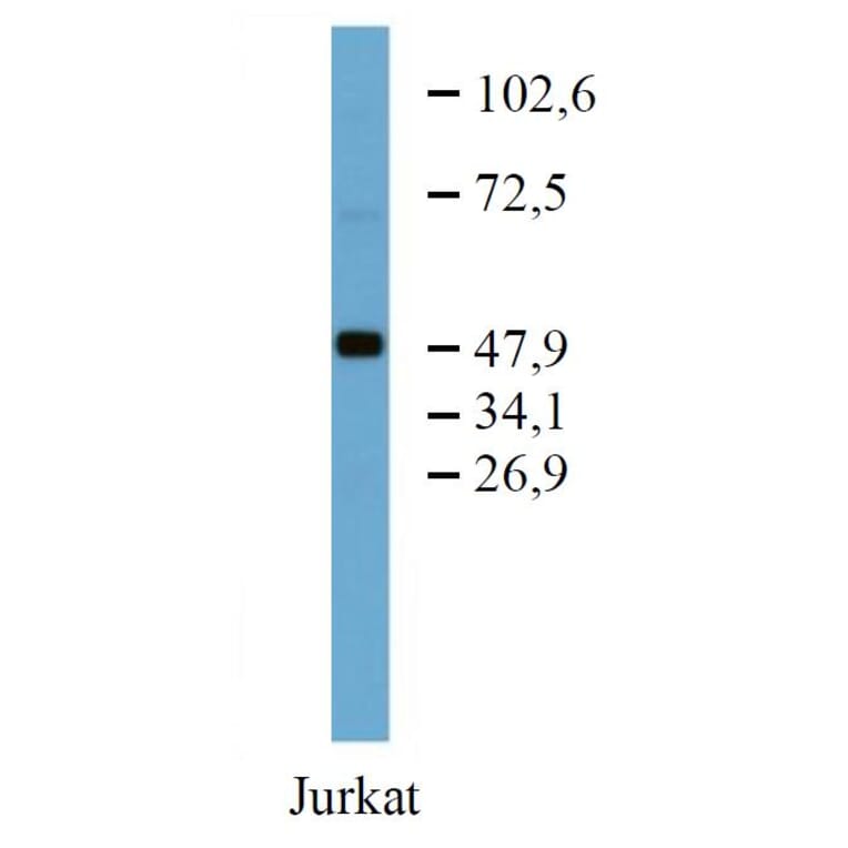 WB - Anti-TRK Fused Gene Antibody [TFG-03] (A86721)