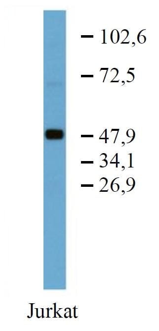 Western blotting analysis of TFG in Jurkat cell lysate using Anti-TFG Antibody (A86721).