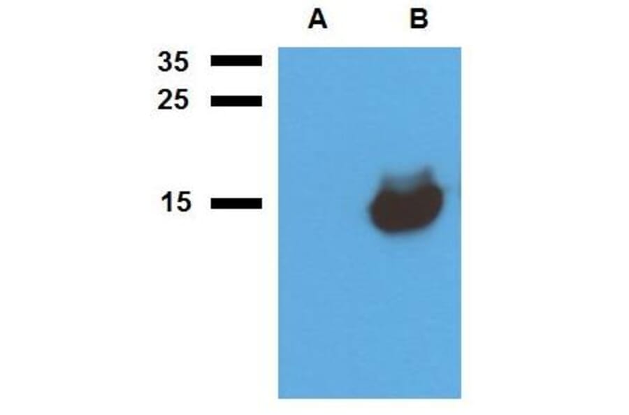 WB - Anti-Mycobacterium tuberculosis Acr1 Antibody (A86725)