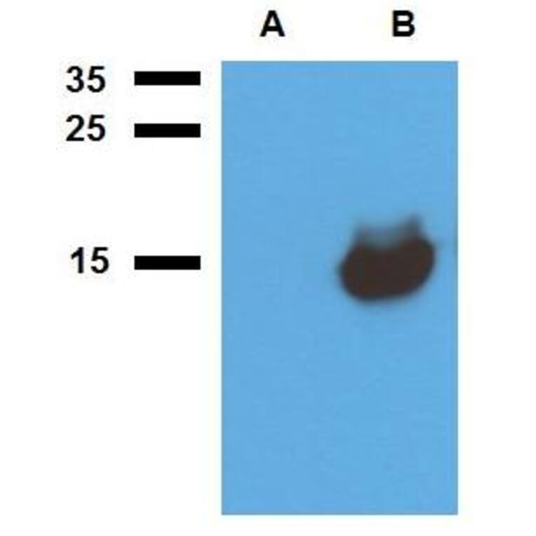 WB - Anti-Mycobacterium tuberculosis Acr1 Antibody (A86725)