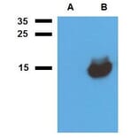 WB - Anti-Mycobacterium tuberculosis Acr1 Antibody (A86725)