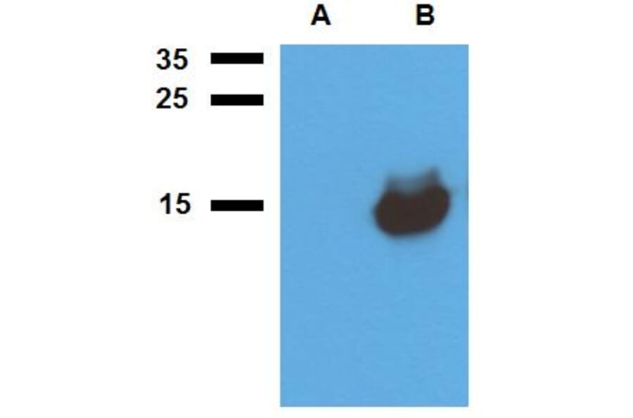 Western Blot - Anti-Mycobacterium tuberculosis Acr1 Antibody (A86724) - Antibodies.com