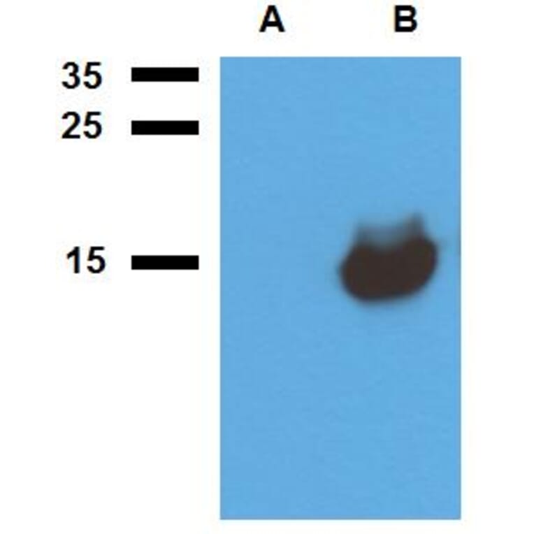 Western Blot - Anti-Mycobacterium tuberculosis Acr1 Antibody (A86724) - Antibodies.com