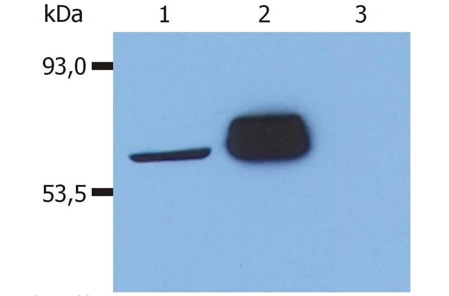 WB - Anti-LCK Antibody [LCK-01] (A86727)