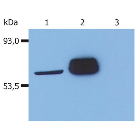 Western Blot - Anti-LCK Antibody [LCK-01] (A86726) - Antibodies.com