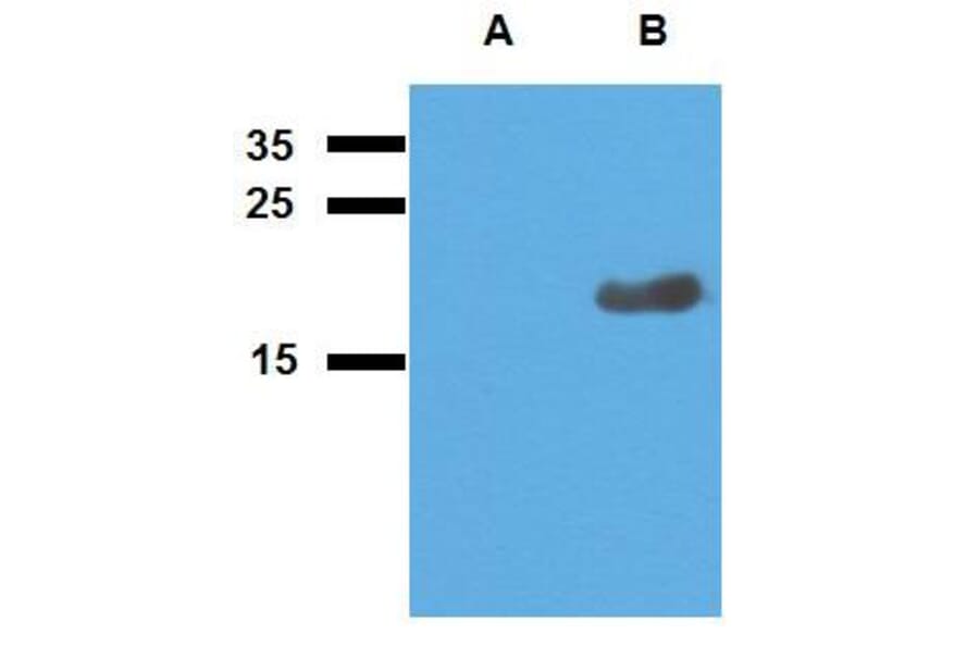 WB - Anti-Mycobacterium tuberculosis Acr2 Antibody (A86731)