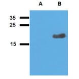 WB - Anti-Mycobacterium tuberculosis Acr2 Antibody (A86731)