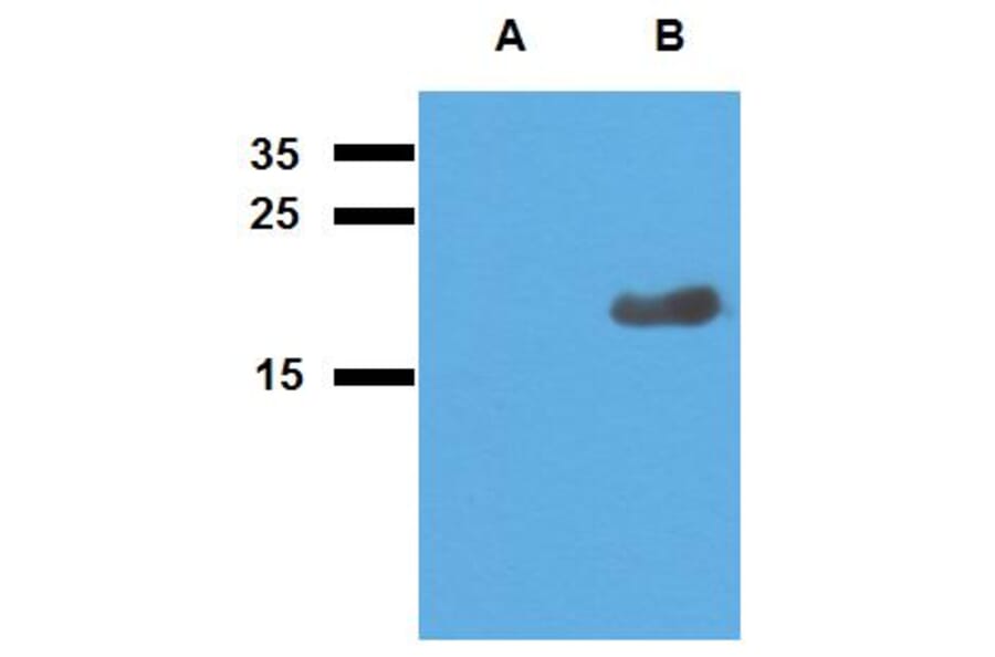 Western Blot - Anti-Mycobacterium tuberculosis Acr2 Antibody (A86730) - Antibodies.com