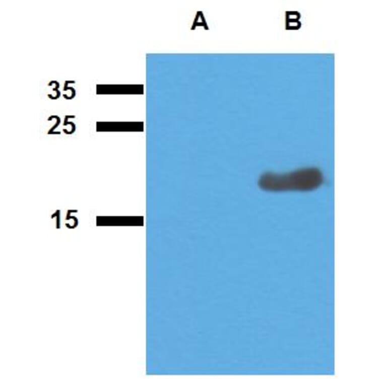 Western Blot - Anti-Mycobacterium tuberculosis Acr2 Antibody (A86730) - Antibodies.com