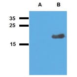 Western Blot - Anti-Mycobacterium tuberculosis Acr2 Antibody (A86730) - Antibodies.com