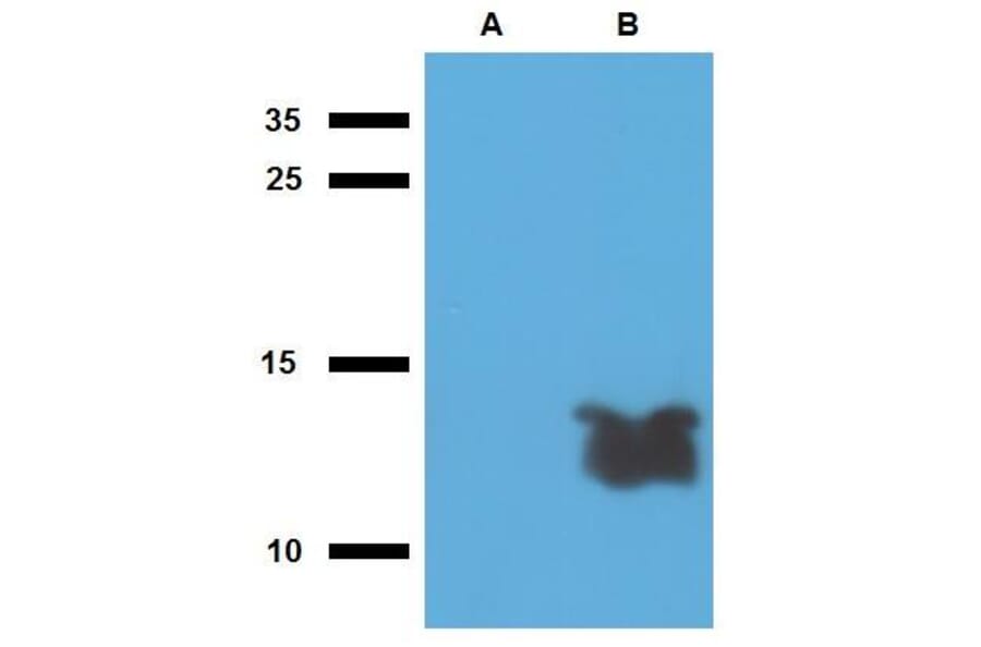 WB - Anti-Mycobacterium tuberculosis Tb7.7 Antibody (A86738)
