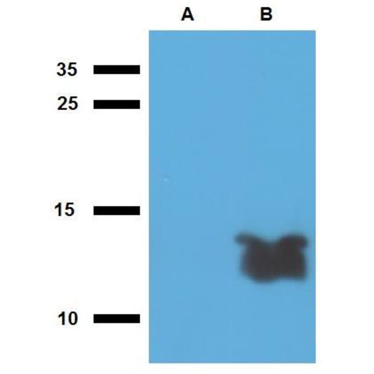 WB - Anti-Mycobacterium tuberculosis Tb7.7 Antibody (A86738)