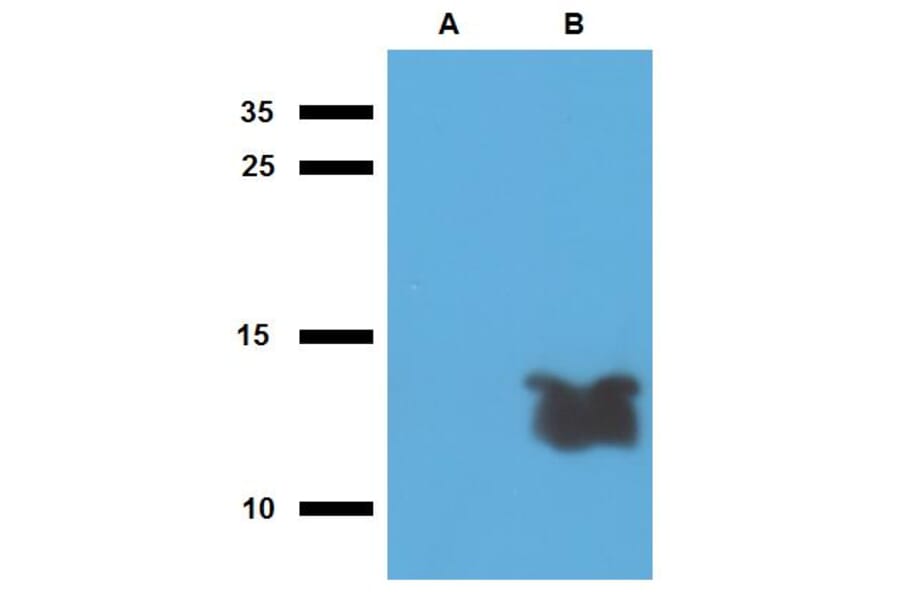 Western Blot - Anti-Mycobacterium tuberculosis Tb7.7 Antibody (A86736) - Antibodies.com