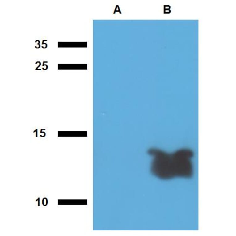 Western Blot - Anti-Mycobacterium tuberculosis Tb7.7 Antibody (A86736) - Antibodies.com