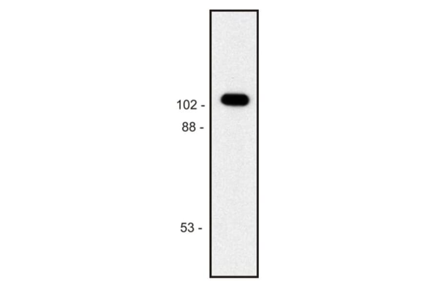 Western Blot - Anti-beta Galactosidase Antibody [BG-02] (A86752) - Antibodies.com