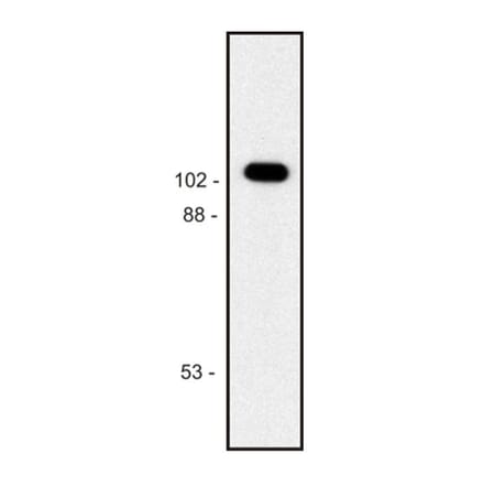 Western Blot - Anti-beta Galactosidase Antibody [BG-02] (A86752) - Antibodies.com