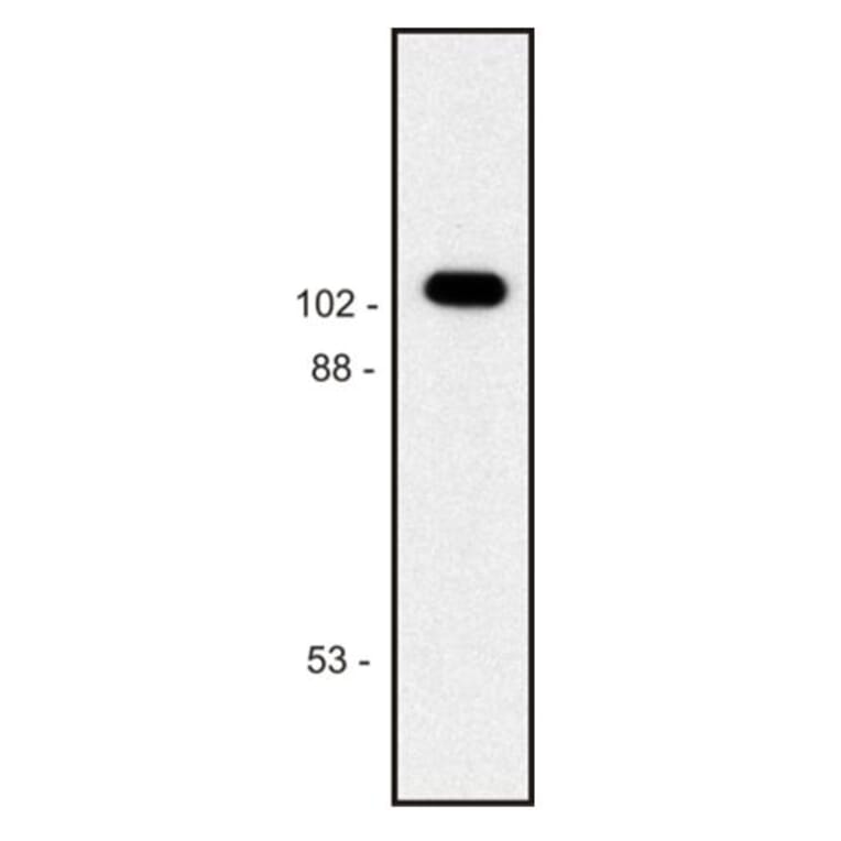 Western Blot - Anti-beta Galactosidase Antibody [BG-02] (A86752) - Antibodies.com