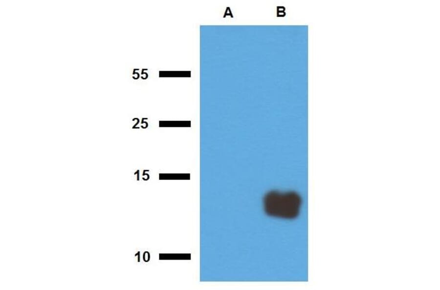WB - Anti-Mycobacterium tuberculosis Tb10.3 Antibody (A86756)
