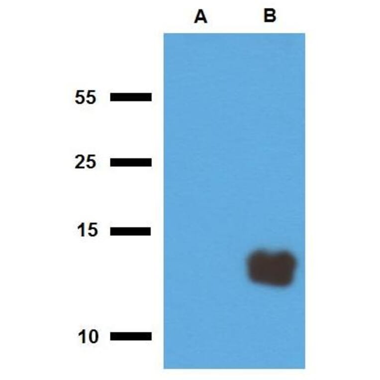 WB - Anti-Mycobacterium tuberculosis Tb10.3 Antibody (A86756)