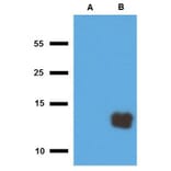 WB - Anti-Mycobacterium tuberculosis Tb10.3 Antibody (A86756)