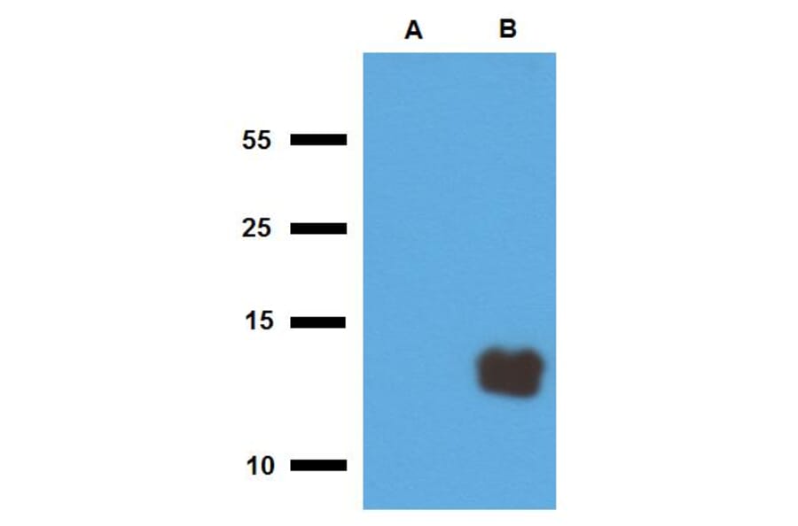 Anti-Mycobacterium tuberculosis Tb10.3 Antibody (A86756)