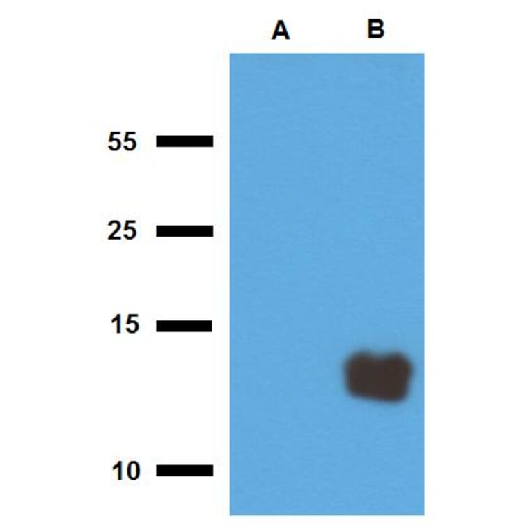 Western Blot - Anti-Mycobacterium tuberculosis Tb10.3 Antibody (A86754) - Antibodies.com