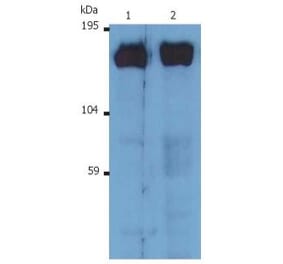 WB - Anti-SOS1 Antibody [SOS-01] (A86758)