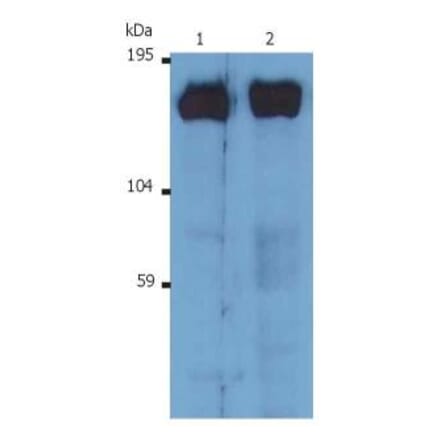 WB - Anti-SOS1 Antibody [SOS-01] (A86758)