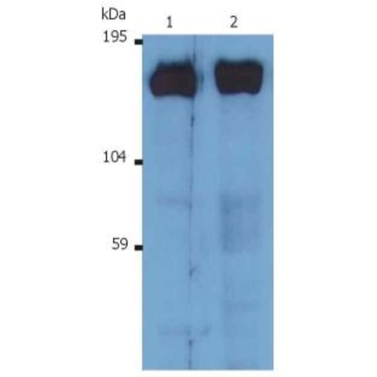 WB - Anti-SOS1 Antibody [SOS-01] (A86758)