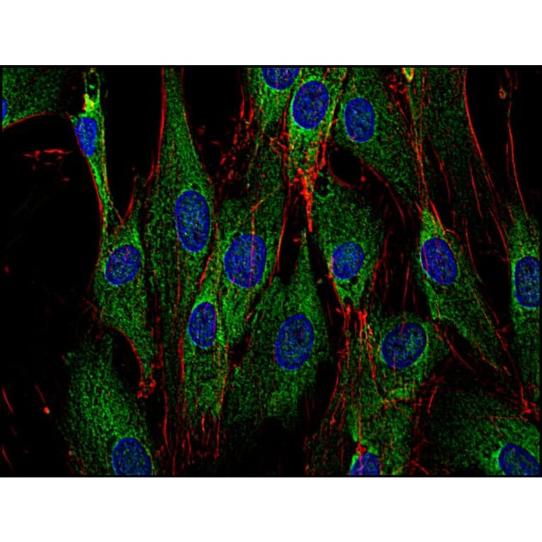 Immunocytochemistry - Anti-SOS1 Antibody [SOS-01] (A86756) - Antibodies.com