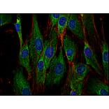 Immunocytochemistry - Anti-SOS1 Antibody [SOS-01] (A86756) - Antibodies.com