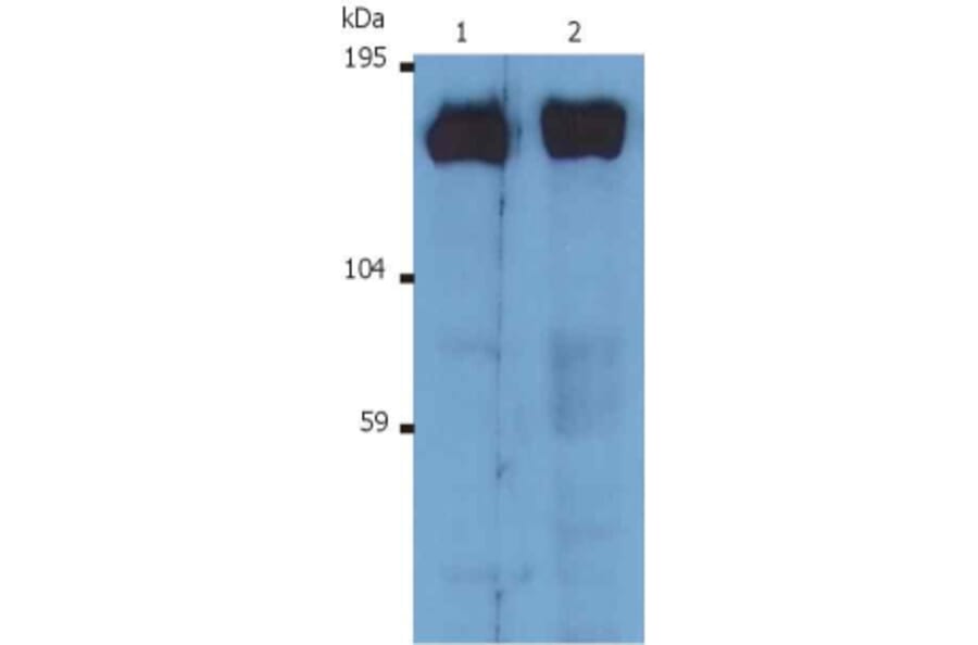 Western Blot - Anti-SOS1 Antibody [SOS-01] (A86758) - Antibodies.com