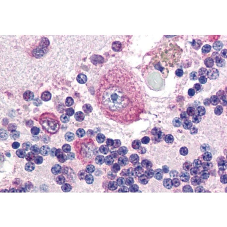 IHC - Anti-Placental Alkaline Phosphatase Antibody [H7E8] (A86765)