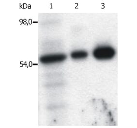 IP - Anti-FYN Antibody [FYN-01] (A86767)