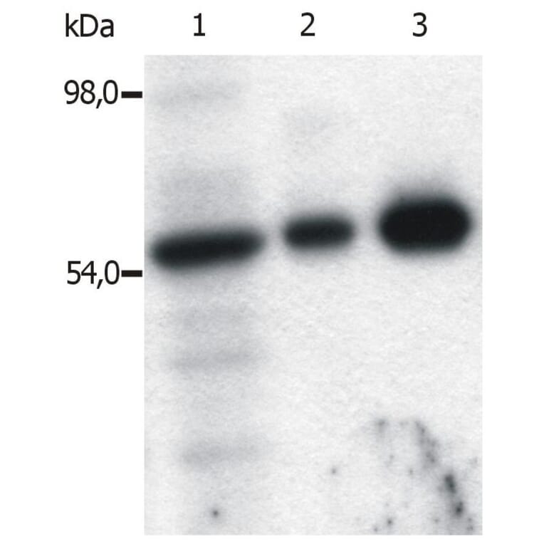 IP - Anti-FYN Antibody [FYN-01] (A86767)