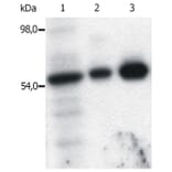 IP - Anti-FYN Antibody [FYN-01] (A86767)