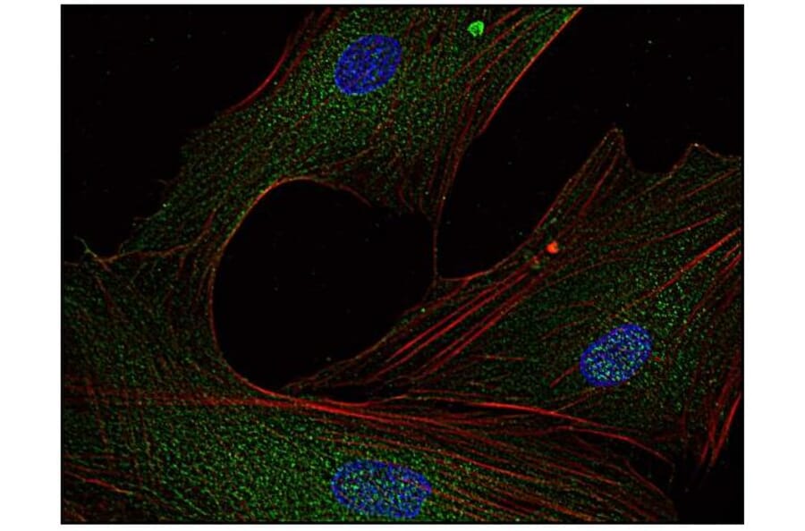 ICC - Anti-FYN Antibody [FYN-01] (A86767)