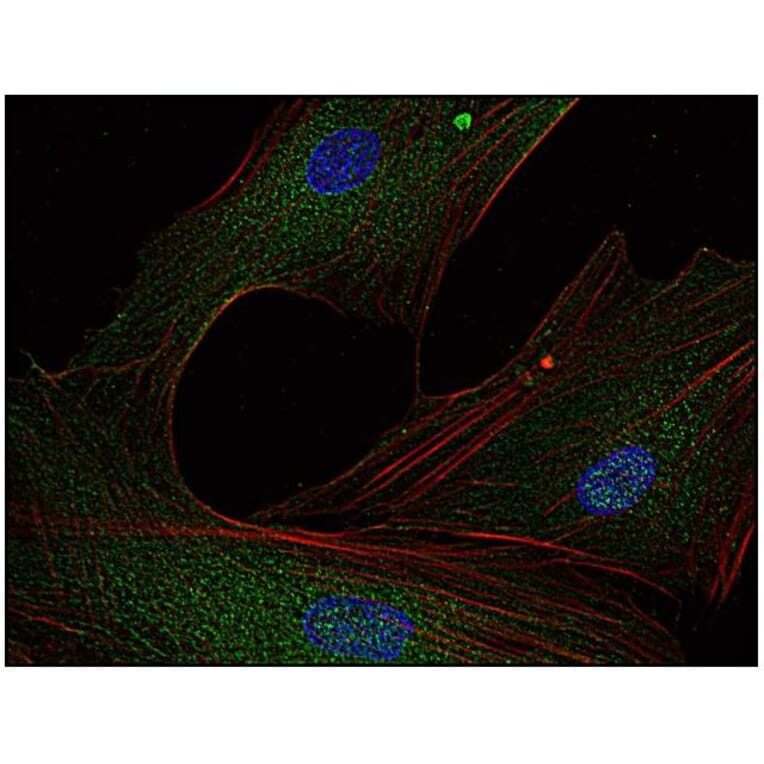 ICC - Anti-FYN Antibody [FYN-01] (A86767)
