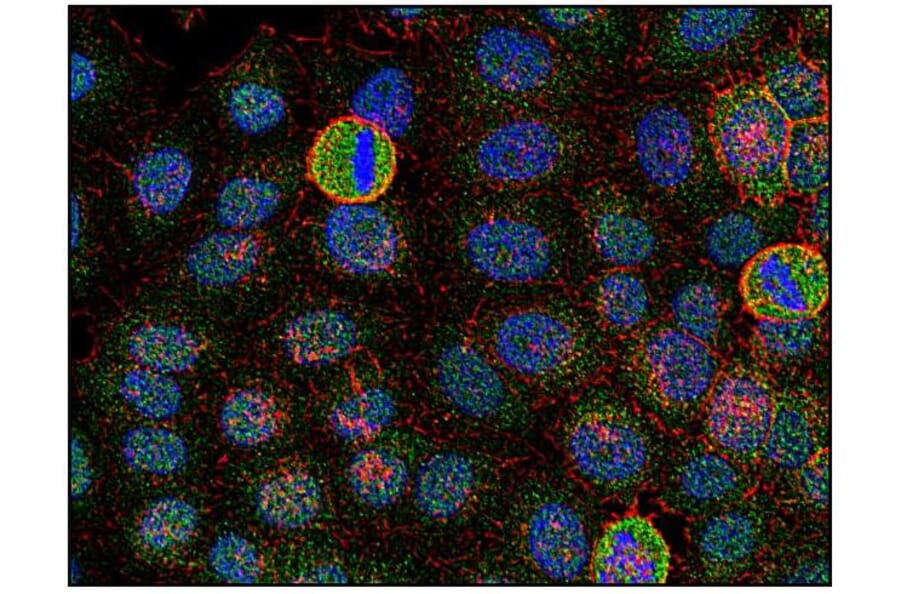 ICC - Anti-FYN Antibody [FYN-01] (A86767)