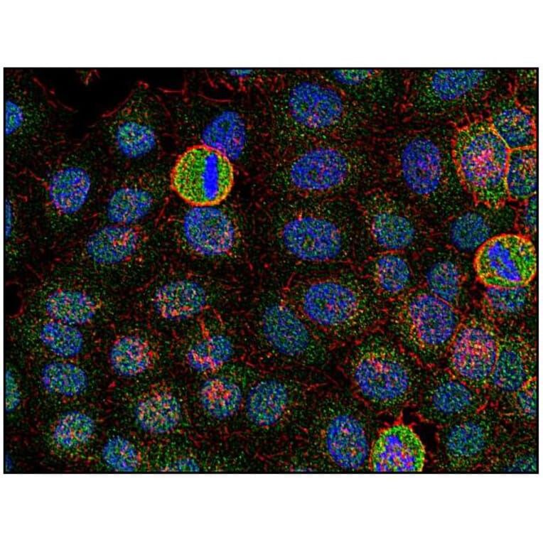 ICC - Anti-FYN Antibody [FYN-01] (A86767)
