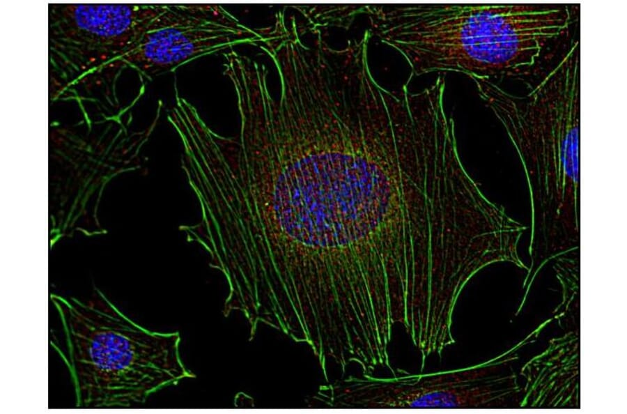ICC - Anti-FYN Antibody [FYN-01] (A86767)