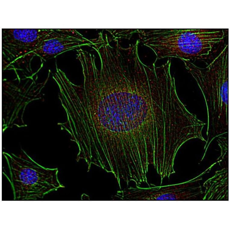 ICC - Anti-FYN Antibody [FYN-01] (A86767)