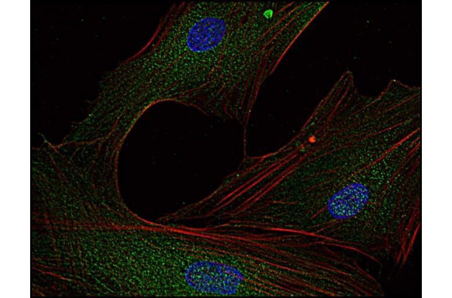 Immunocytochemistry - Anti-FYN Antibody [FYN-01] (A86767) - Antibodies.com