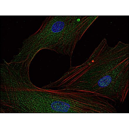 Immunocytochemistry - Anti-FYN Antibody [FYN-01] (A86767) - Antibodies.com