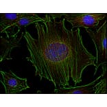 Immunocytochemistry - Anti-FYN Antibody [FYN-01] (A86767) - Antibodies.com