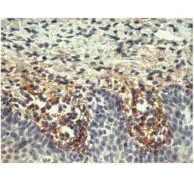 IHC - Anti-Tenascin C Antibody [T2H5] (A86776)