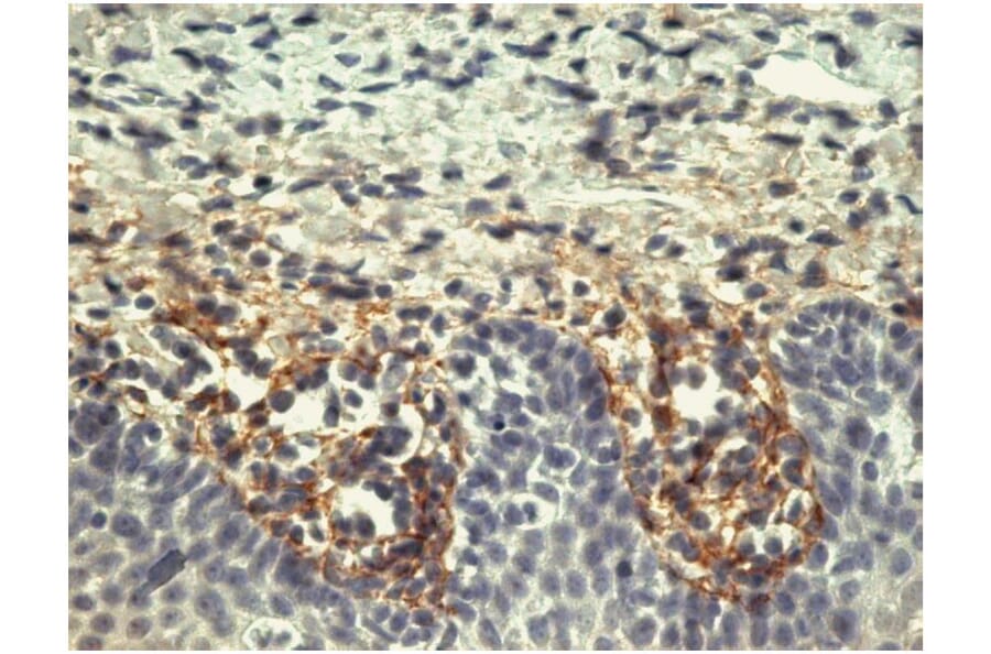 IHC - Anti-Tenascin C Antibody [T2H5] (A86776)