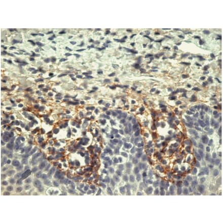 IHC - Anti-Tenascin C Antibody [T2H5] (A86776)